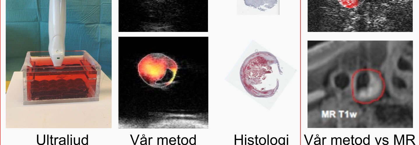 visuell jämförelse mellan Ex vivo och Histologi.