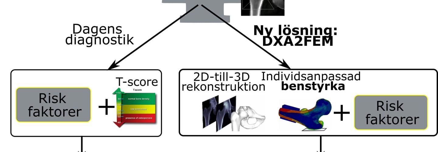 Träddiagram som visar resultat av röntgen med och utan förbättrad diagnostik